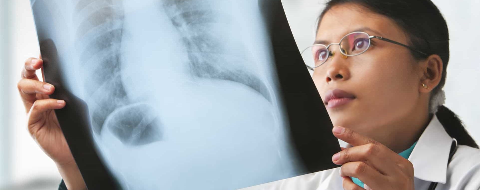 Female doctor checking xray image